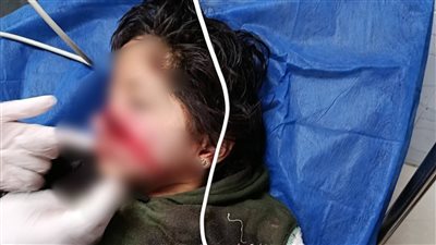 غضب واسع بين الأهالي بعد إصابة طفلة في واقعة صادمة بدمياط