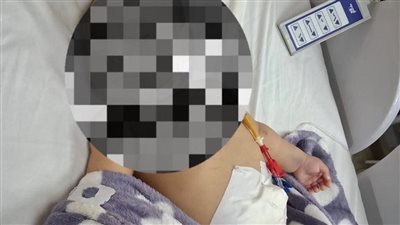 مستشفى دمياط العام ينجح في إنقاذ طفلة من حالة حرجة بفشل كلوي