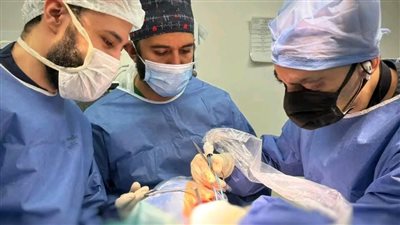 لأول مرة بمجمع الإسماعيلية الطبي.. استئصال ورم بقاع الجمجمة بتقنية متقدمة ضمن التأمين الصحي الشامل 