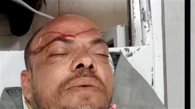 بالفيديو بالصور.. إصابة شخص صدمته سيارة أثناء عبوره الطريق الدائري بالفيوم 