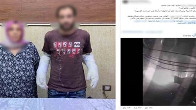 ضبط سباك ووالدته أشعلا النيران في جسد عامل بعين شمس