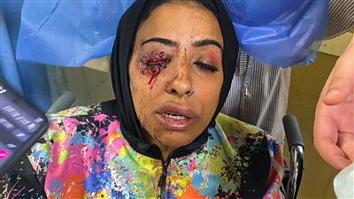 أسرة أمنية خالد تناشد الجهات المختصة سرعة ضبط المتهمين والتحقيق في الواقعة