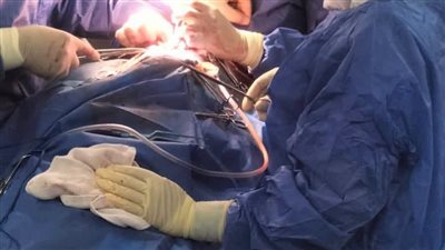 دمياط العام يجري جراحة عاجلة لتفريغ نزيف بالمخ وإنقاذ حياة شاب