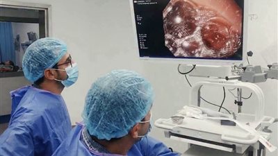 لأول مرة.. تشغيل خدمة مناظير الجهاز الهضمي بمستشفى طوخ المركزي