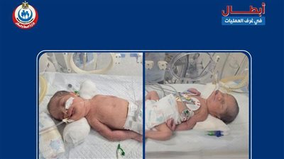 ماتت الأم فأنقذ الأطباء توأمها.. كواليس إنقاذ «رحيم وريان» من بطن والدتهما بعد وفاتها بسوهاج