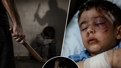قصة طفل في الثالثة.. اعتداء بالحزام وإصابات بالغة ينتهي بالحبس 3 سنوات